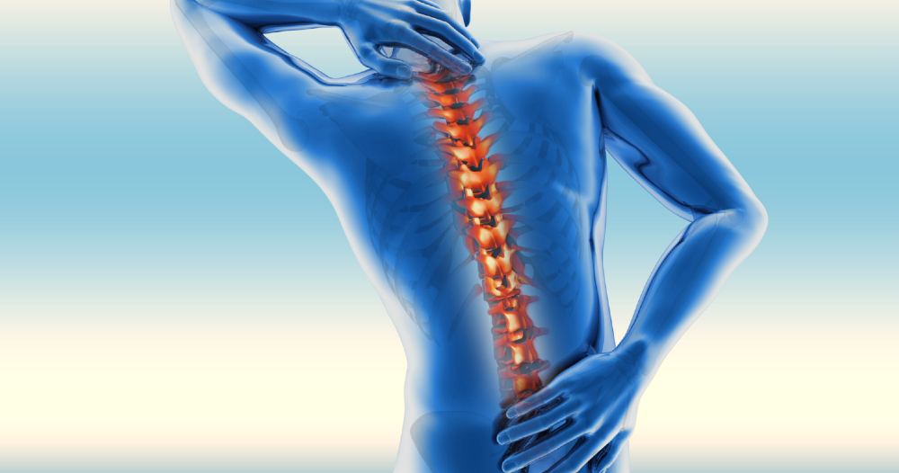 Ankilozirajočispondilitis.jpg